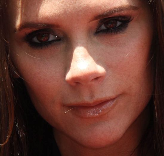 Victoria Beckahm pokonała problemy ze skórą w nietypowy sposób. Jaki? Victoria Beckahm pokonała problemy ze skórą w nietypowy sposób. Jaki?