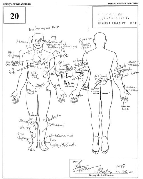 Ciało Whitney Houston było poparzone gorącą wodą Ciało Whitney Houston było poparzone gorącą wodą