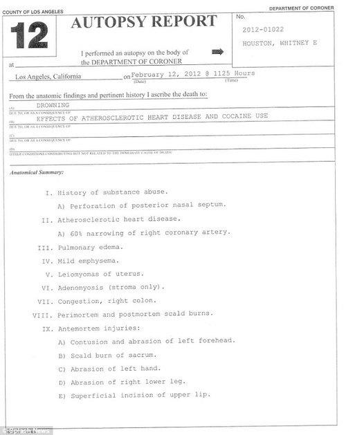 Ciało Whitney Houston było poparzone gorącą wodą Ciało Whitney Houston było poparzone gorącą wodą