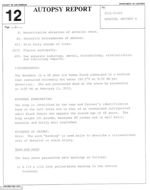 Ciało Whitney Houston było poparzone gorącą wodą Ciało Whitney Houston było poparzone gorącą wodą