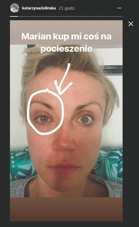 Zielińska bez makijażu straszy CHORYM okiem: Marian kup mi coś na pocieszenie!