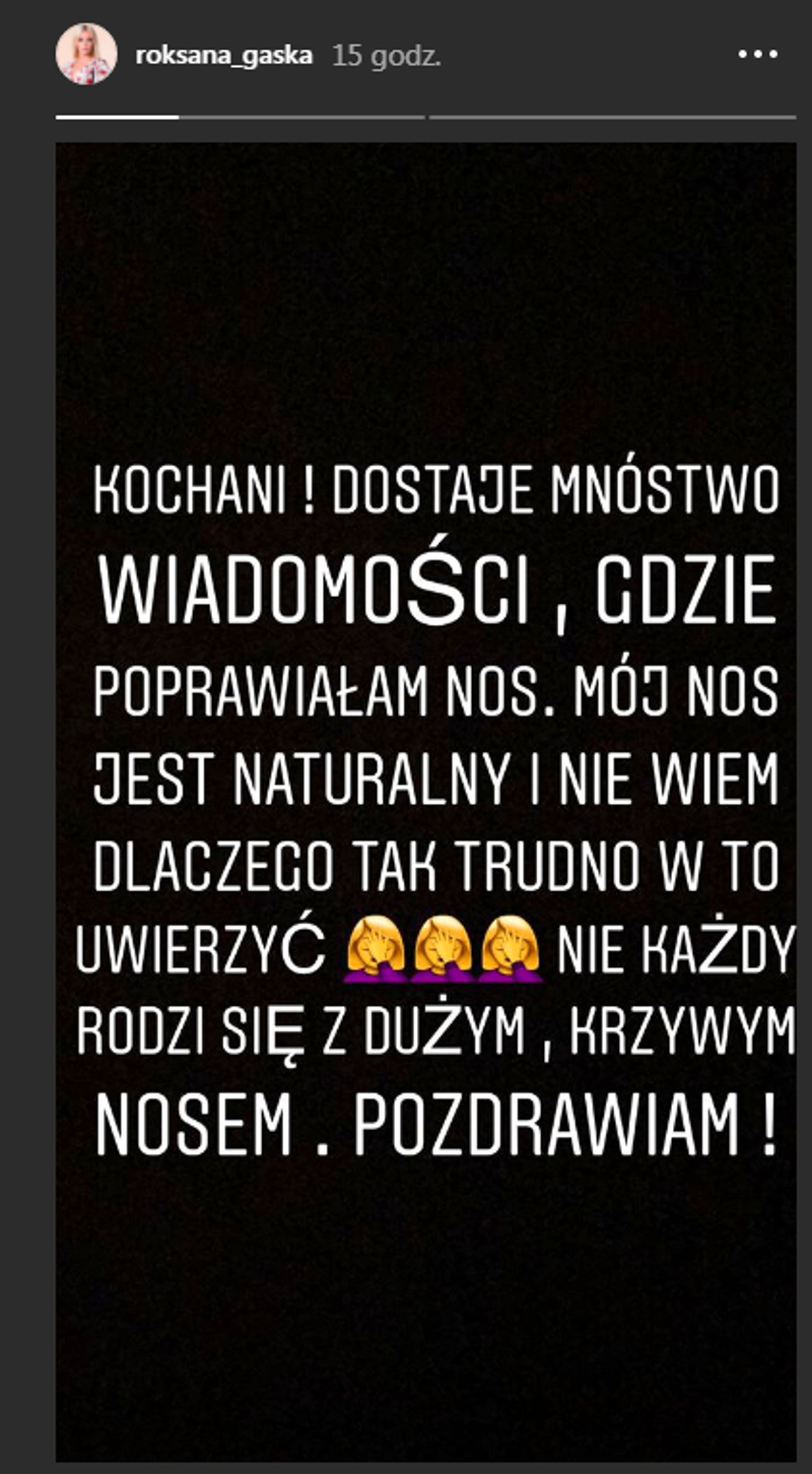 Wściekła Roxi Gąska przyznaje: mój nos jest NATURALNY, pośladki i POLICZKI też! Wściekła Roxi Gąska przyznaje: mój nos jest NATURALNY, pośladki i POLICZKI też!