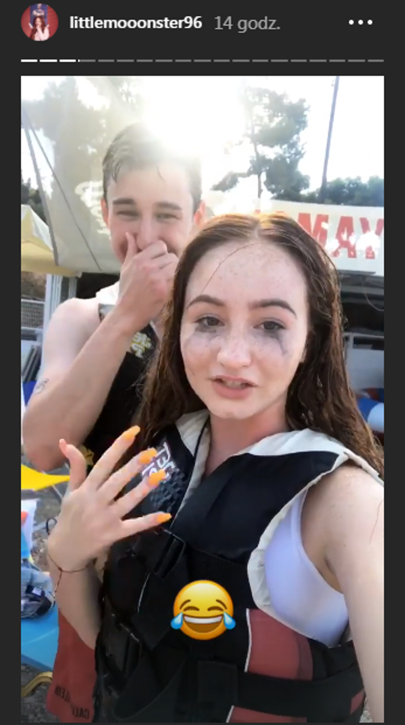 Zobaczcie, co się stało z TWARZĄ Angeliki Muchy! Musiała się tym pochwalić!