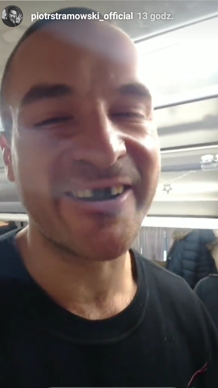 Starmowski bez ZĘBÓW: dostałem po ryju!