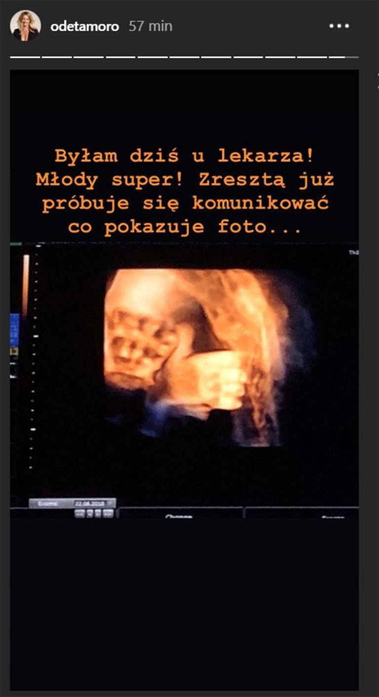 Odeta Moro pokazała PIERWSZE zdjęcie synka! 