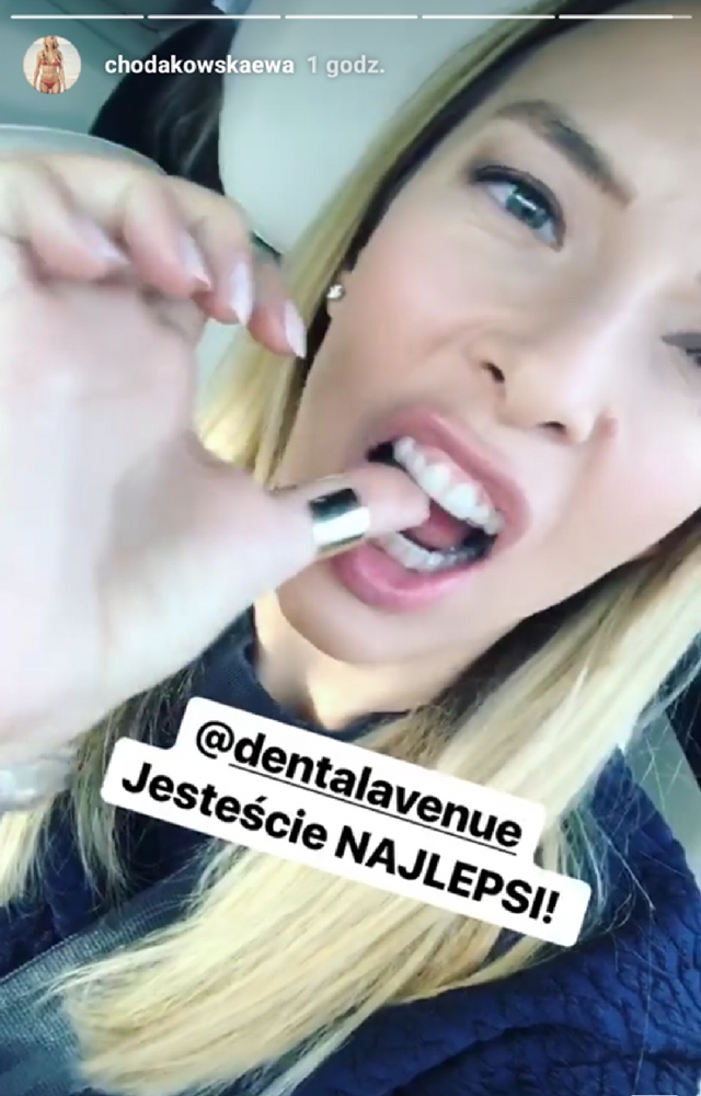 SZOK! Chodakowska dłubie sobie w zębach! 