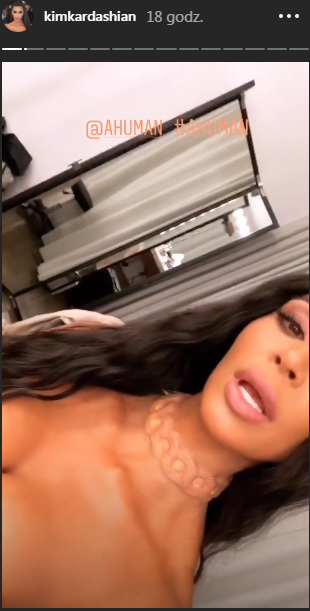 Coś dziwnego pojawiło się na dekolcie Chrissy Teigen! Czy to jakaś narośl?! 