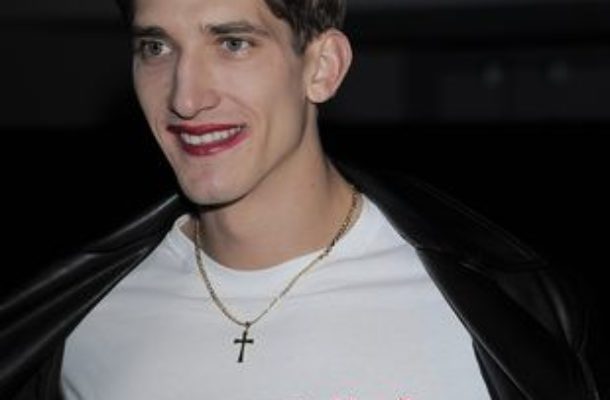 OMG! Co ma na twarzy Michał Baryza? (FOTO)