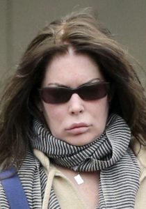 Lara Flynn Boyle zmasakrowała sobie twarz! (FOTO) Lara Flynn Boyle zmasakrowała sobie twarz! (FOTO)
