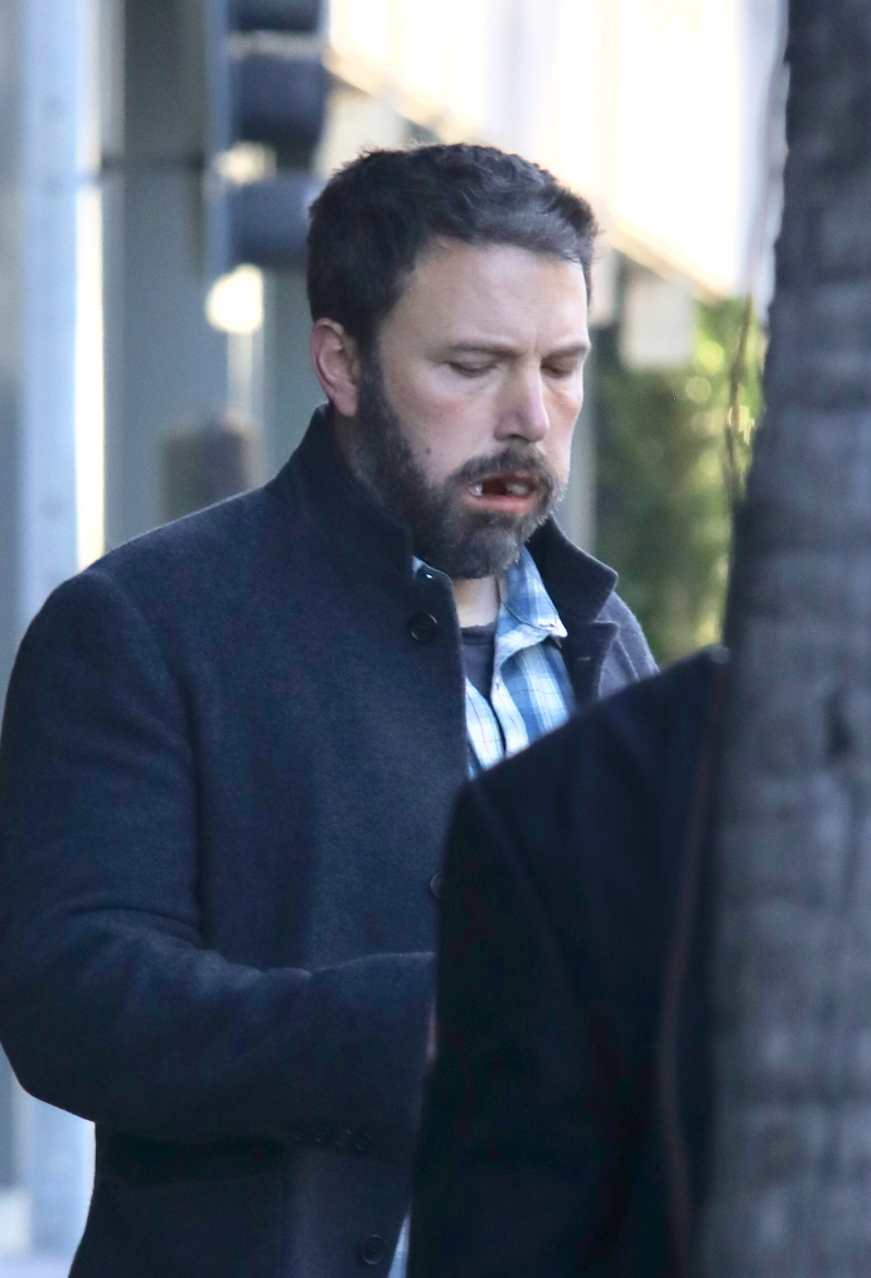 Opuchnięty Ben Affleck wychodzi od dentysty. To musiało boleć. Opuchnięty Ben Affleck wychodzi od dentysty. To musiało boleć.