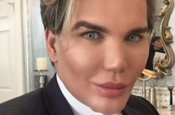 Rodrigo Alve: Odessali mi 3 litry tłuszczu, a potem wstrzyknęli je w tyłek