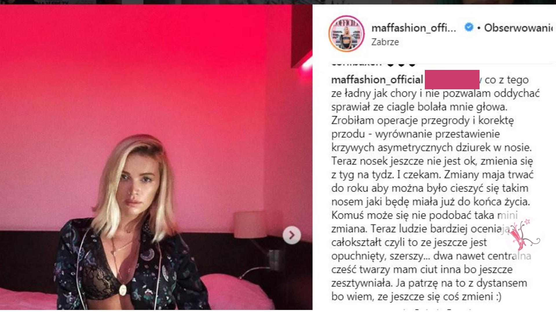 Trudno rozpoznać TWARZ Maffashion! Tłumaczy, dlaczego tak wygląda