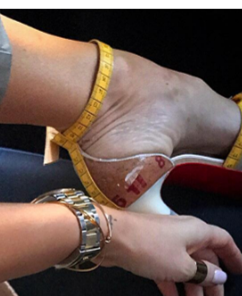 Niefortunne ujęcie, czy to naprawdę pięty Małgosi Rozenek? Niefortunne ujęcie, czy to naprawdę pięty Małgosi Rozenek?