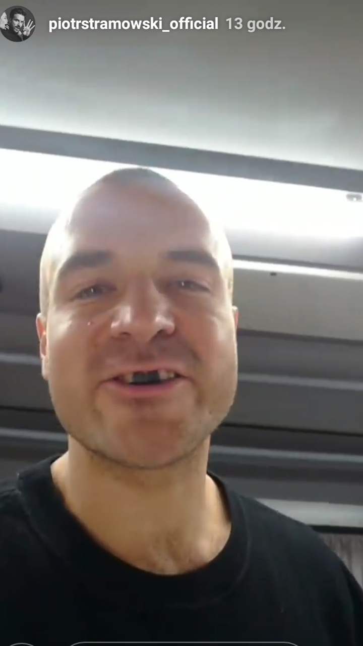 Starmowski bez ZĘBÓW: dostałem po ryju!