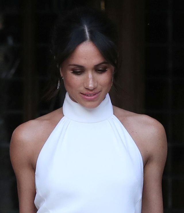 Twarz Meghan Markle przed OPERACJAMI!