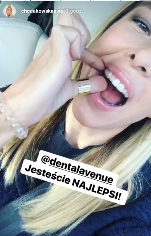 SZOK! Chodakowska dłubie sobie w zębach! 