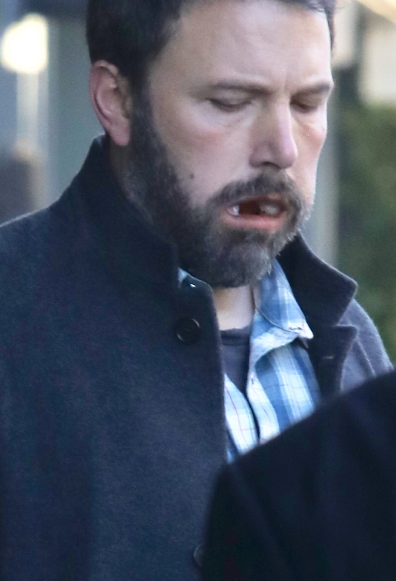 Opuchnięty Ben Affleck wychodzi od dentysty. To musiało boleć. Opuchnięty Ben Affleck wychodzi od dentysty. To musiało boleć.