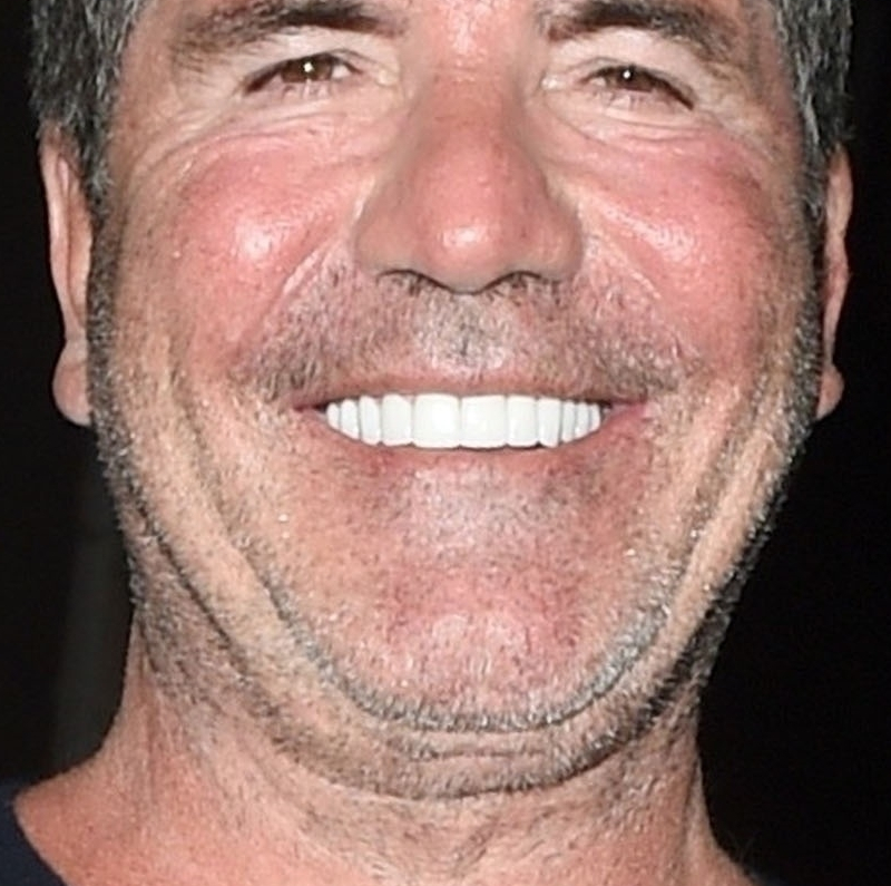 Nowe zęby Simona Cowella aż RAŻĄ! Piękna klawiatura?