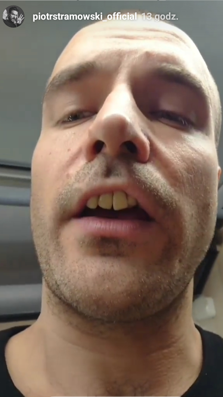 Starmowski bez ZĘBÓW: dostałem po ryju!