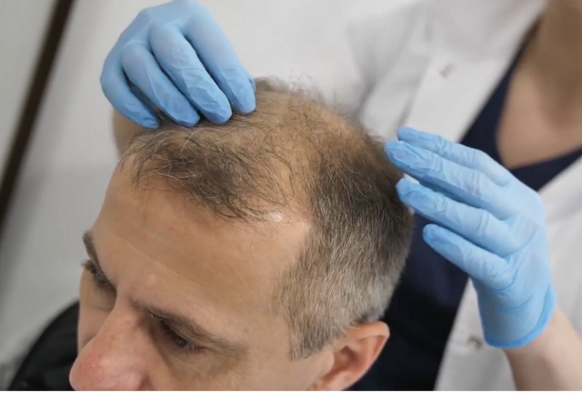 Znana gwiazda OPEROWANA za pomocą ROBOTA! 