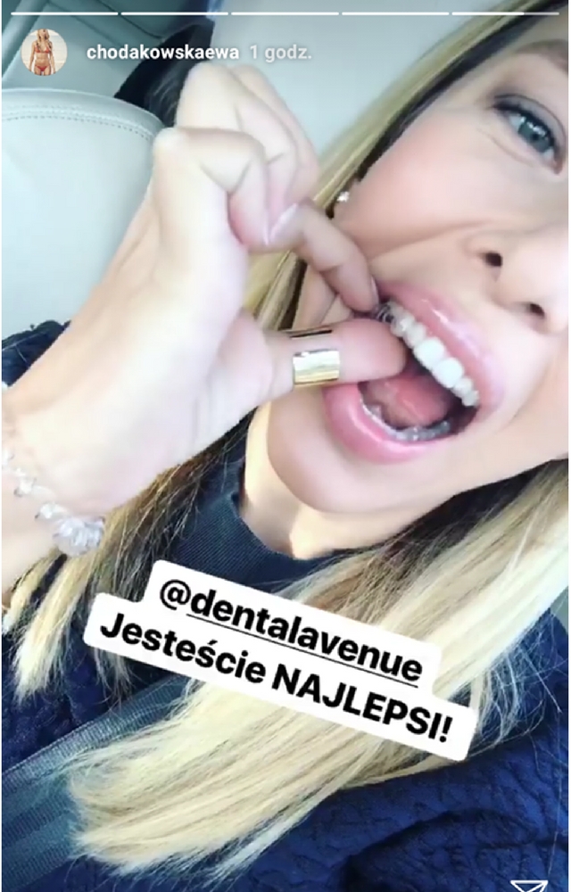 SZOK! Chodakowska dłubie sobie w zębach! 