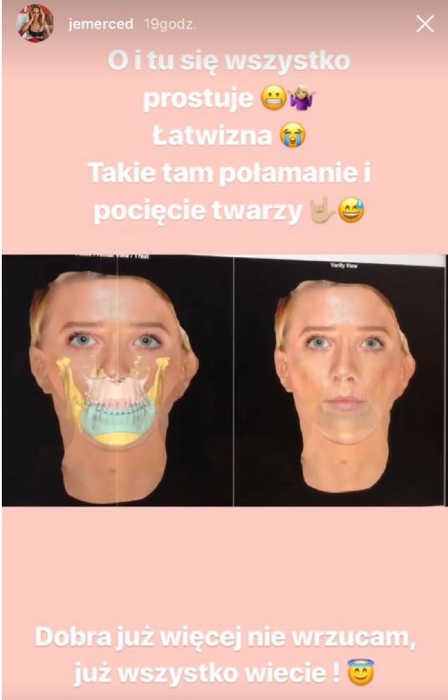 Jessica przeszła ciężką operacja. Od razu po narkozie zaczęła nagrywać na Insta!