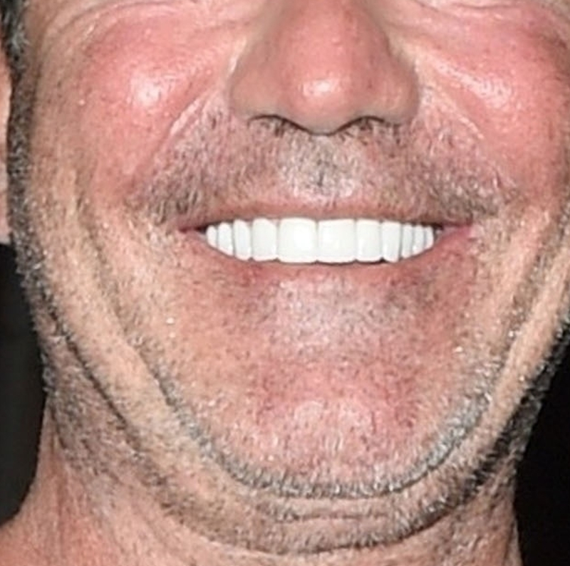 Nowe zęby Simona Cowella aż RAŻĄ! Piękna klawiatura?