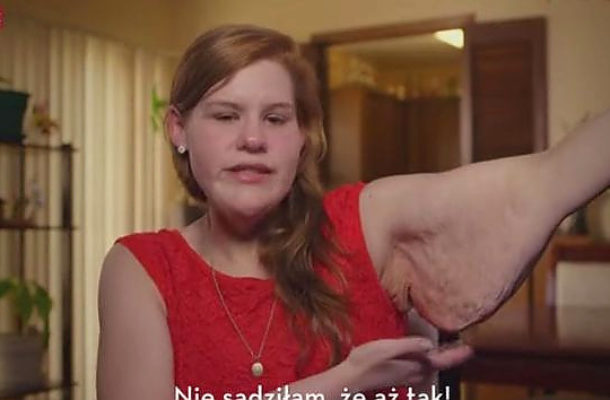 Choć schudła ponad 100 kg, wciąż nie może na siebie patrzeć!