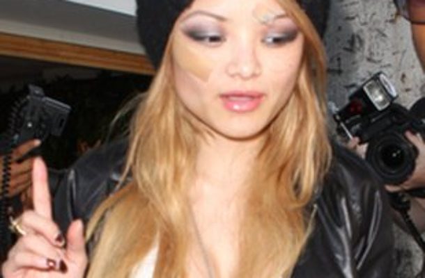 Tila Tequila z plastrami na twarzy (FOTO)