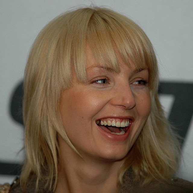 Agnieszka Szulim: Mam otwarty stosunek do medycyny estetyczn