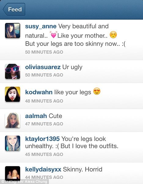Alexa Chung musiała usunąć zdjęcie swoich chudych nóg 