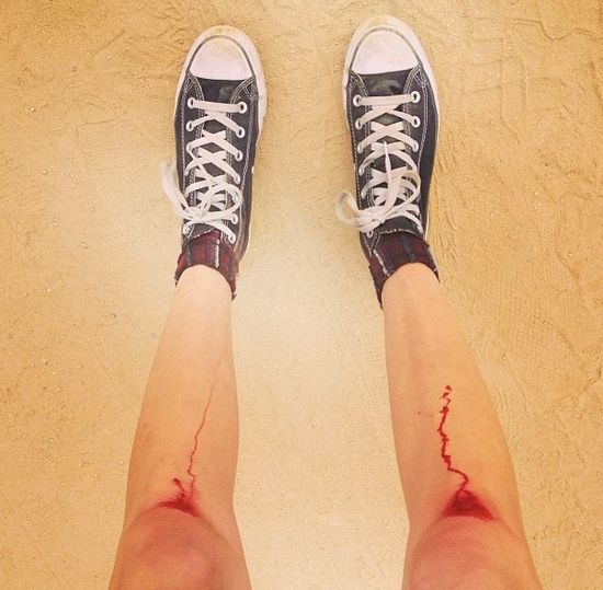 Czyje są te krwawiące nogi? (FOTO)