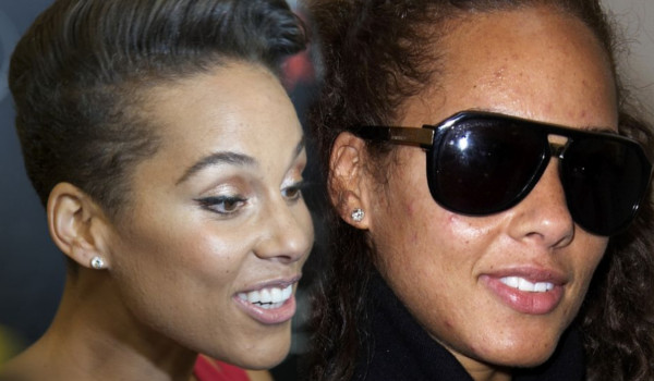 Te gwiazdy borykają się z trądzikiem (FOTO)