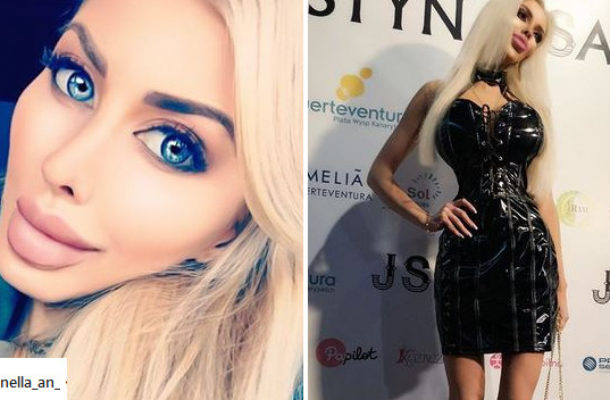 Anelli zaszkodziły OPERACJE! Ma poważne problemy ze zdrowiem (Instagram)