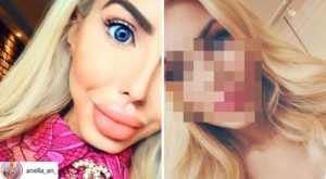 Co się stało Anelli? Wygląda zupełnie INACZEJ (Instagram) Co się stało Anelli? Wygląda zupełnie INACZEJ (Instagram)