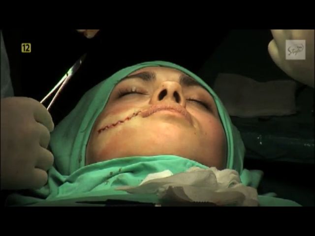 Anna Koryto opowiada o usunięciu blizny (VIDEO)