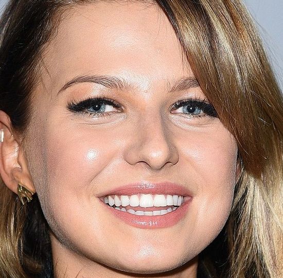 Myśląc o naturalności Anny Lewandowskiej wiele razy zadałeś sobie TO pytanie Myśląc o naturalności Anny Lewandowskiej wiele razy zadałeś sobie TO pytanie