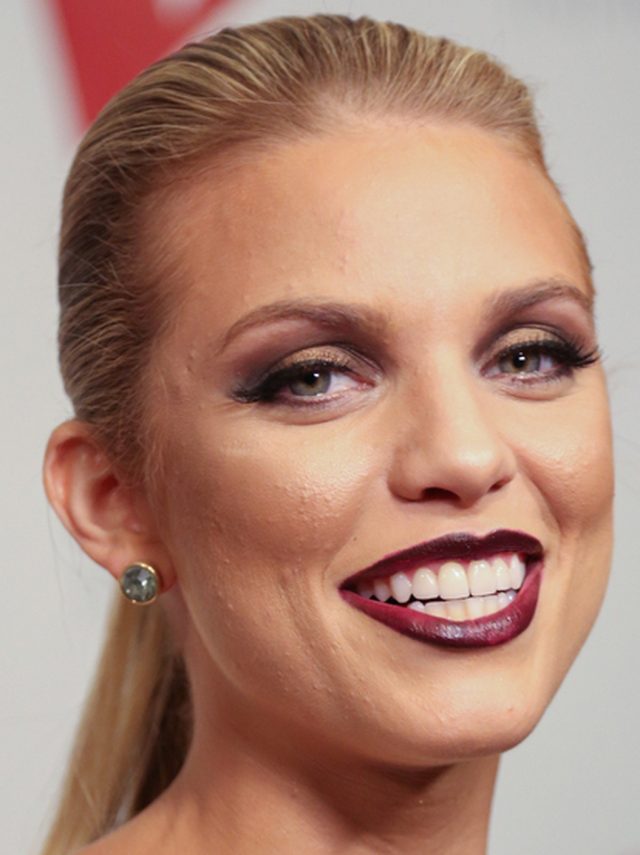 Trądzik to nie tylko przypadłość nastolatek (FOTO)