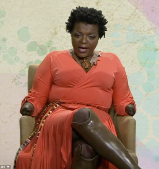 Chciała powiększyć pośladki, została kaleką (FOTO+VIDEO) Chciała powiększyć pośladki, została kaleką (FOTO+VIDEO)