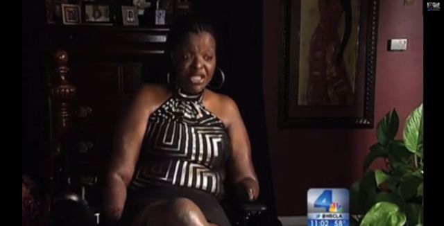 Chciała powiększyć pośladki, została kaleką (FOTO+VIDEO) Chciała powiększyć pośladki, została kaleką (FOTO+VIDEO)