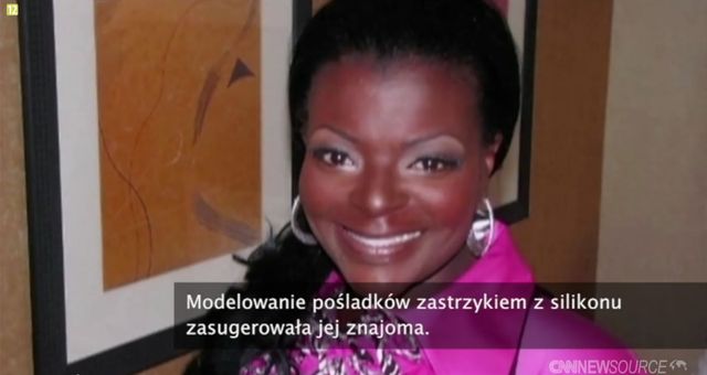 Chciała powiększyć pośladki, została kaleką (FOTO+VIDEO) Chciała powiększyć pośladki, została kaleką (FOTO+VIDEO)