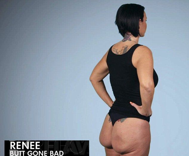 Renee Talley może obracać swoje implanty w pośladkach VIDEO