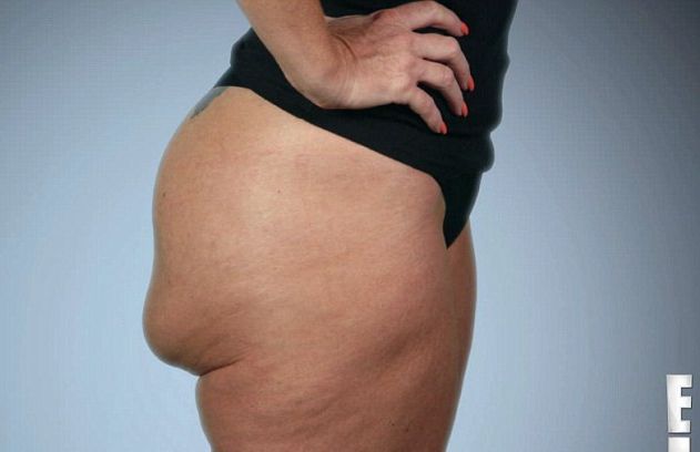 Renee Talley może obracać swoje implanty w pośladkach VIDEO