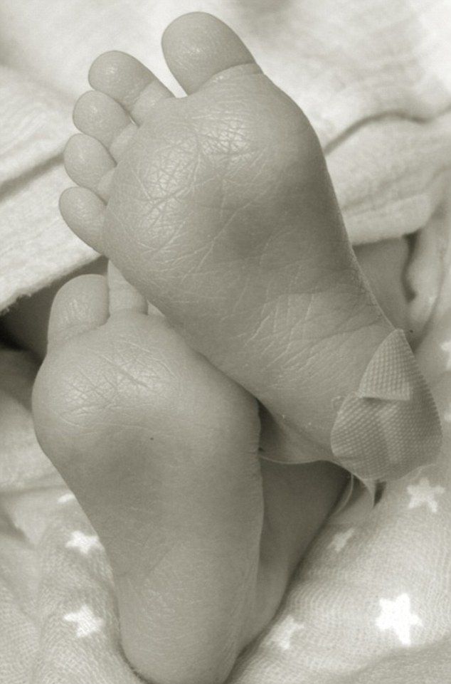 Pokazała swój brzuch tydzień po cesarce (FOTO) Pokazała swój brzuch tydzień po cesarce (FOTO)