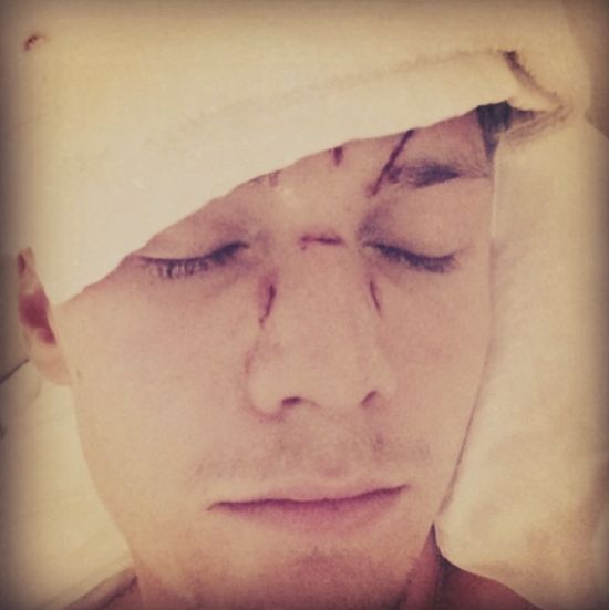 Lindsay Lohan zaatakowała brata Paris Hilton!