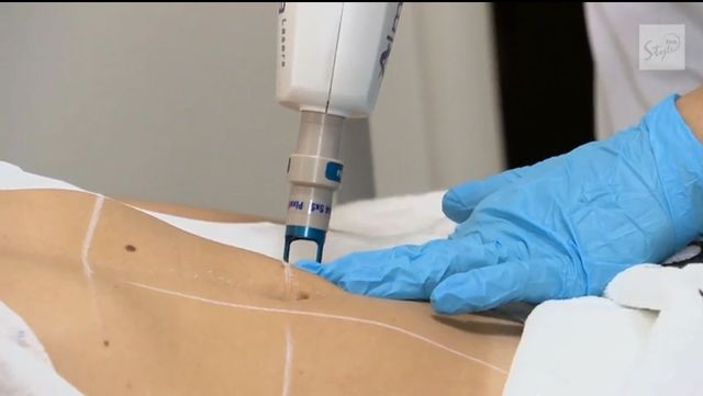 Basia Kurdej-Szatan już poprawia urodę (FOTO)