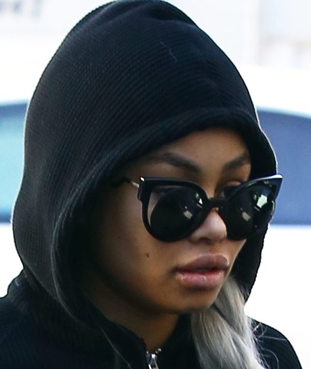 Blac Chyna też przyjechała do dermatologa (FOTO) Blac Chyna też przyjechała do dermatologa (FOTO)