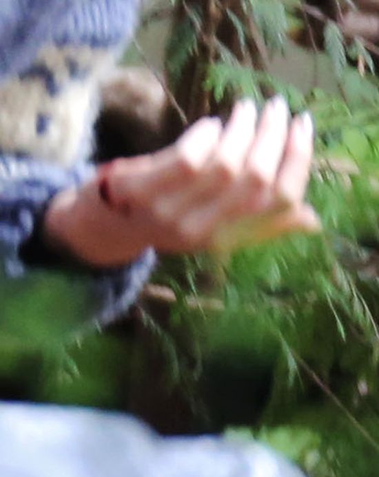 Blake Lively poważnie zraniła się na planie filmu! (FOTO)