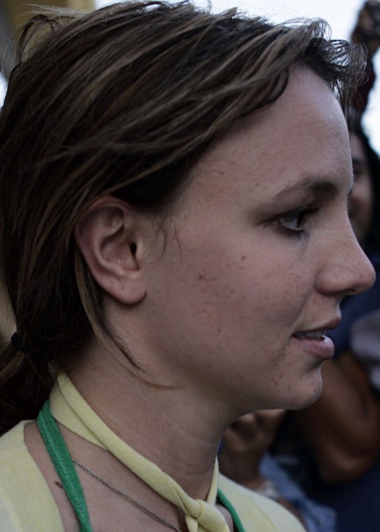 Te gwiazdy borykają się z trądzikiem (FOTO)