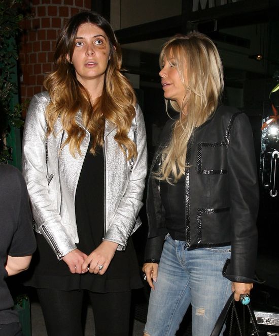 Przyjaciółka Kim Kardashian chodzi z limo pod okiem (FOTO)